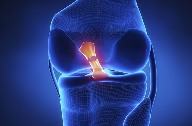 Ligament Injuries Treatment in JP Nagar