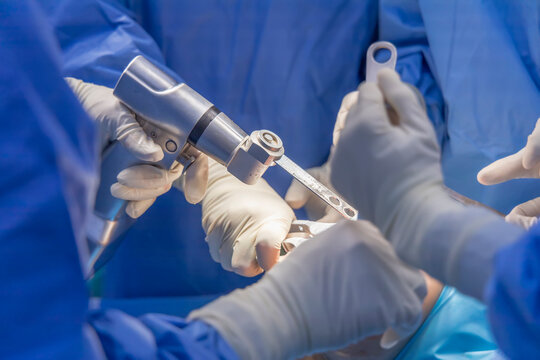 Arthroplasty surgeon Arthroplasty surgeon in JP Nagar