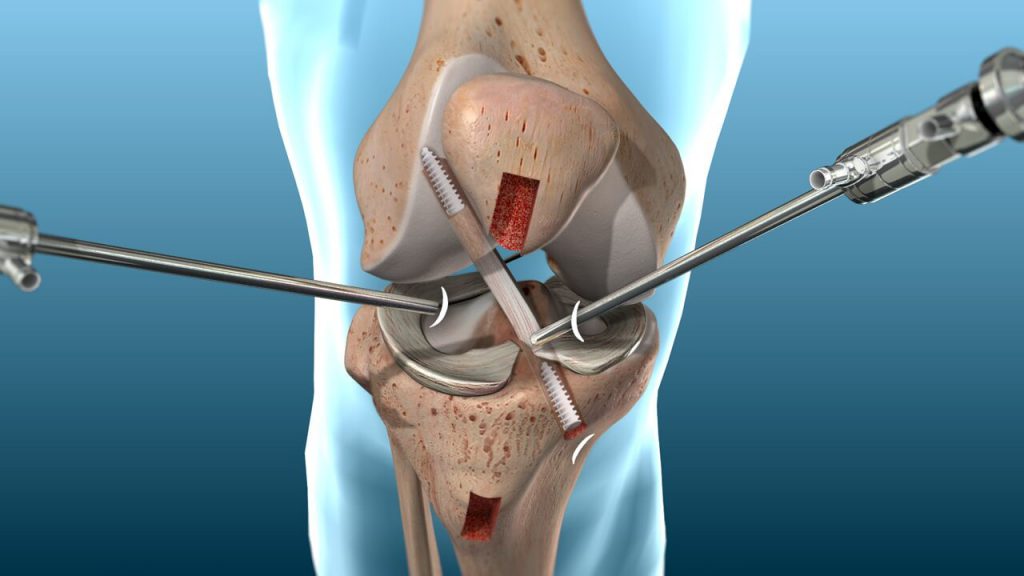Pcl Surgeon in Banashankari