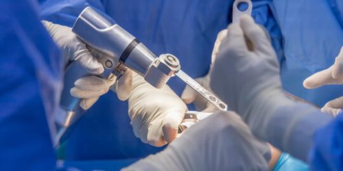 Arthroplasty surgeon in JP Nagar
